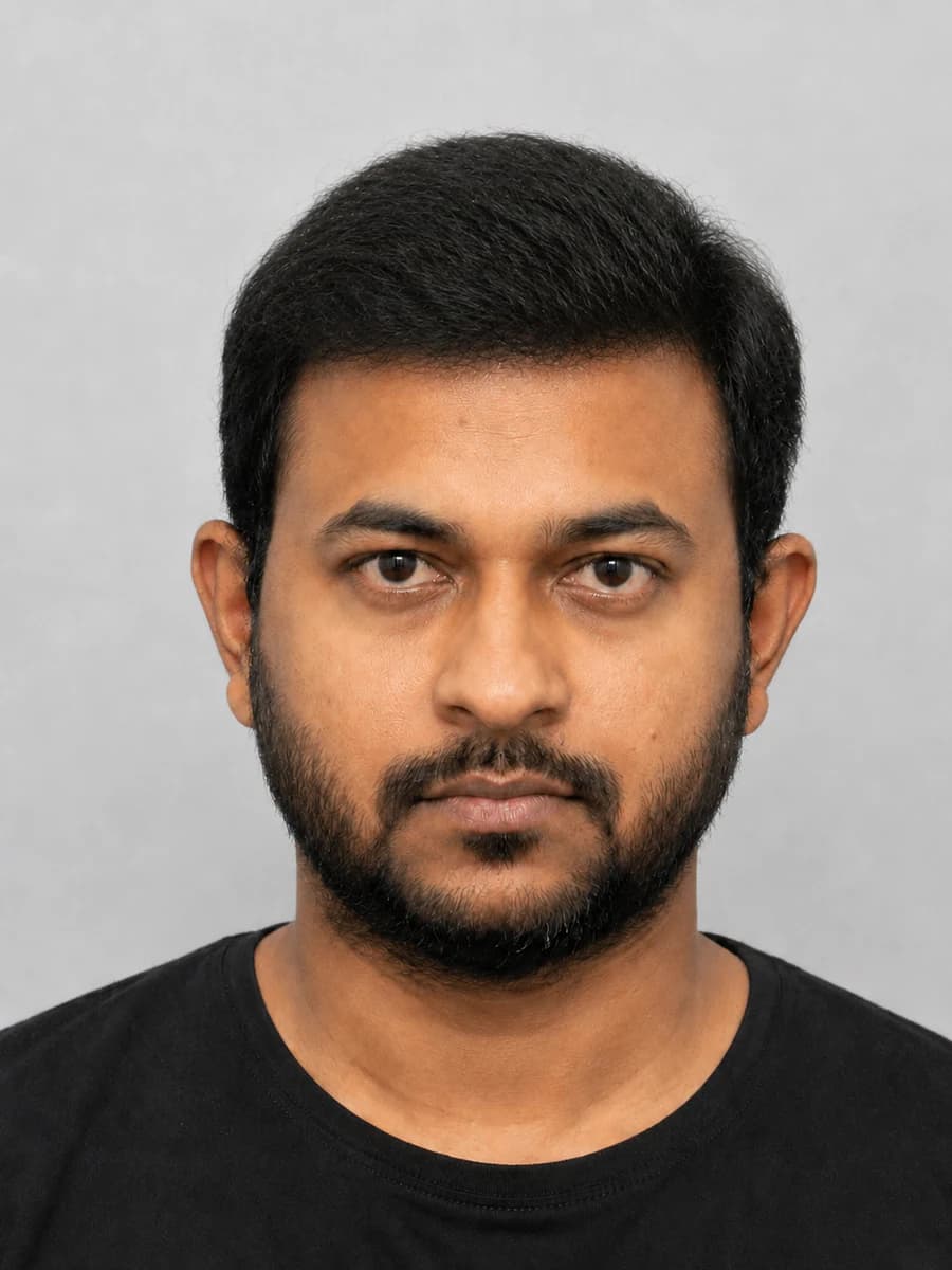 Hair transplant improvement example showing restored hair density after treatment at Radiance Clinics Bhubaneswar, front view Advanced Male Pattern Baldness